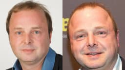 Die Todesursache von Wolfgang Feindt: Ein umfassender Überblick