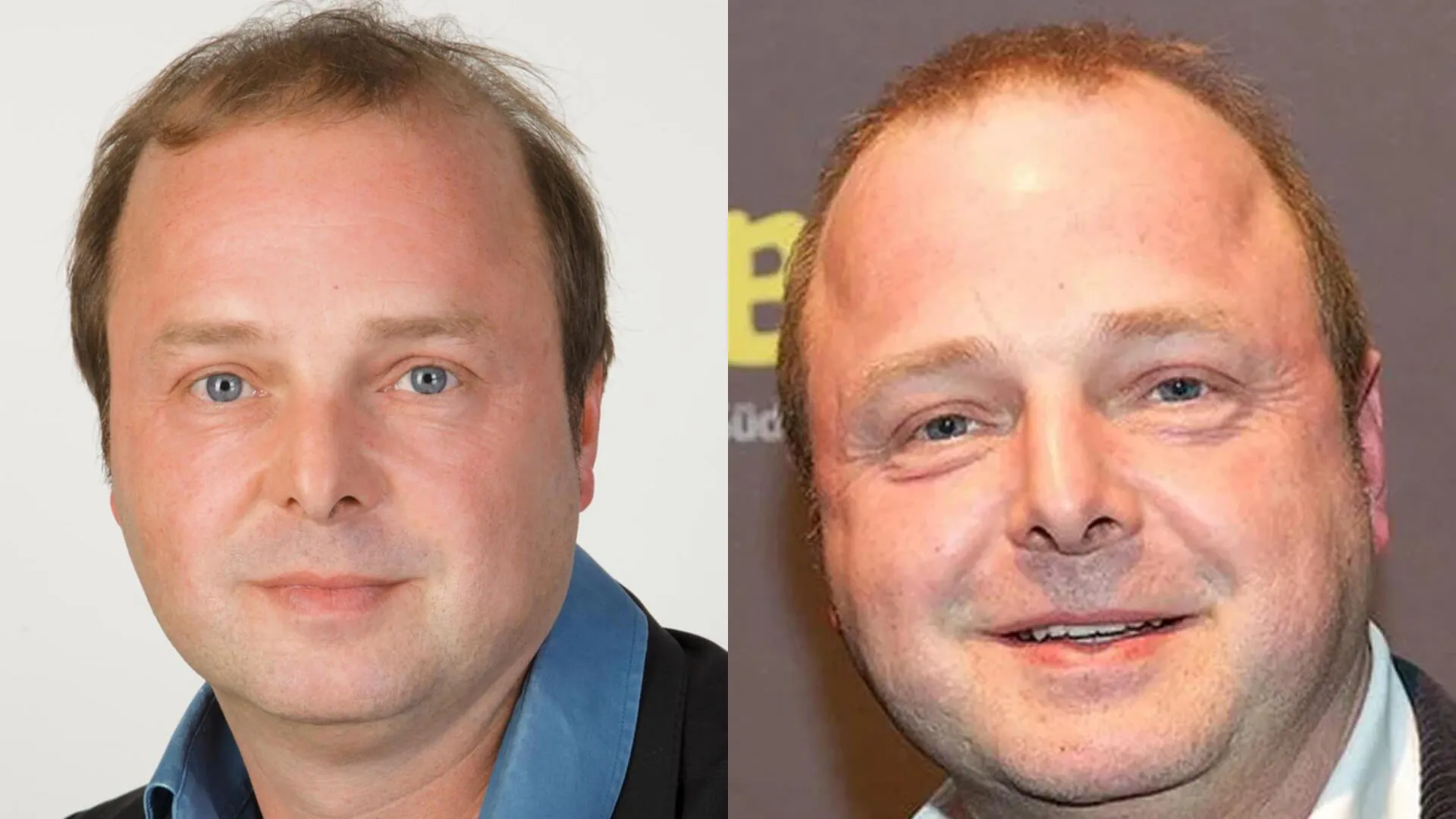 Die Todesursache von Wolfgang Feindt: Ein umfassender Überblick